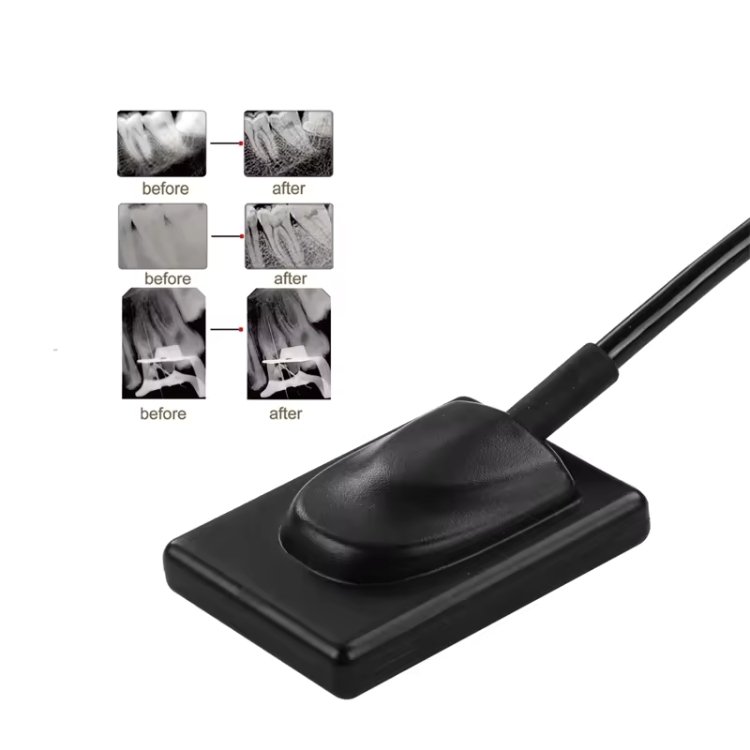 dental portable rvg x ray sensor