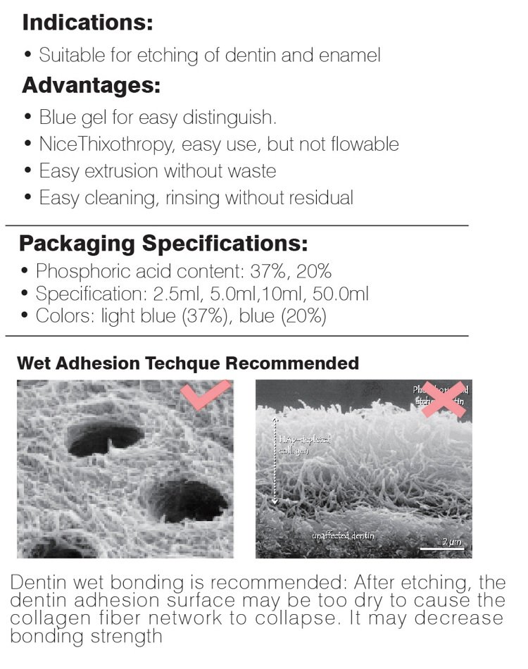 dental etching gel 37%