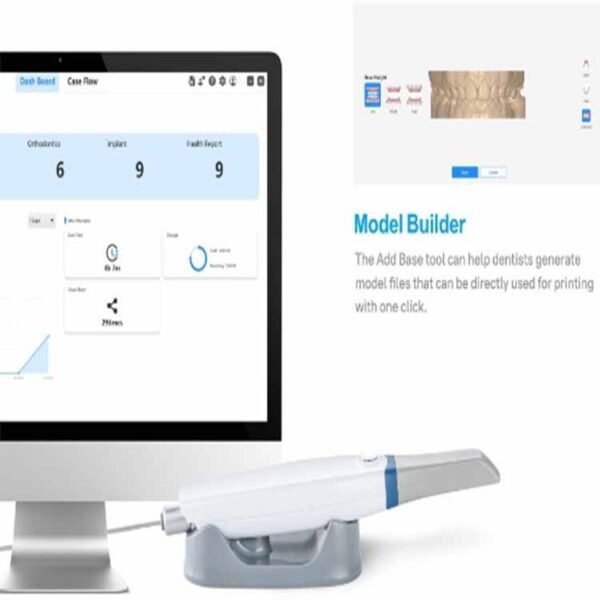 3d true color intra oral scanner