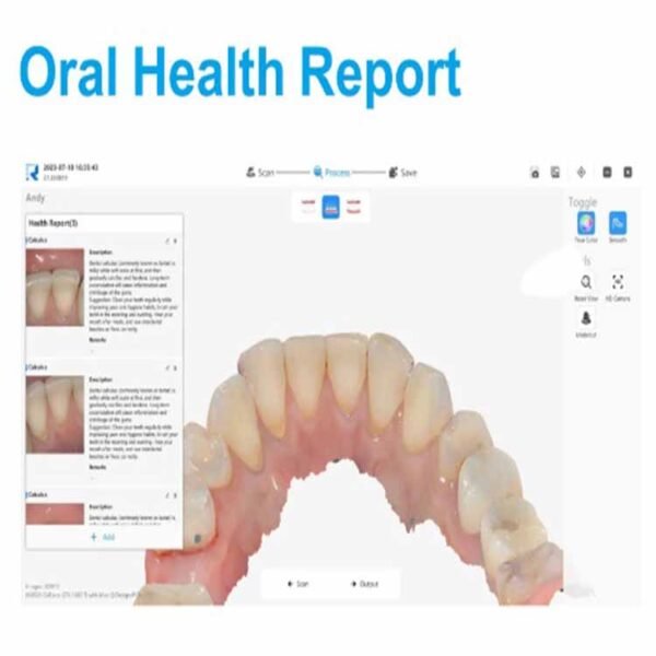 3d intra oral scanner